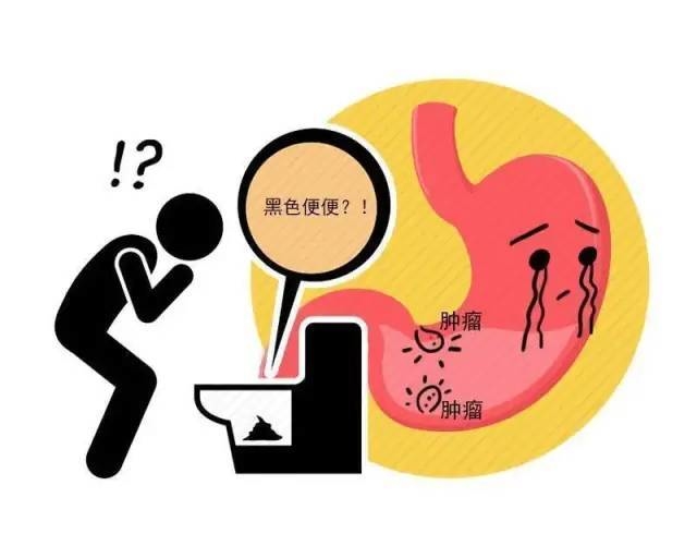 生活小百科丨提醒：身体频繁出现4个异样，说明胃部已癌变，需及时就医检查！