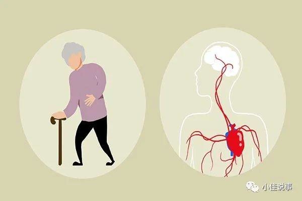 生活小百科丨身体有4种情况，提醒你开始“老”了