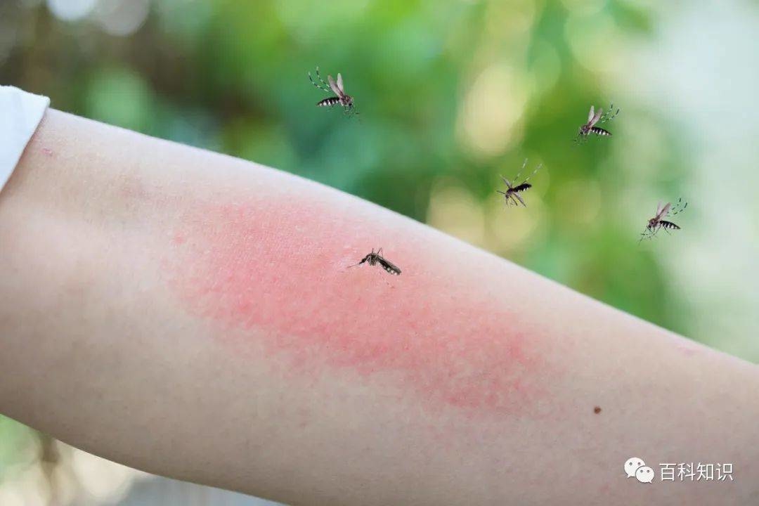 百科知识丨夏天蚊子少，是蚊子都被“热死”了吗