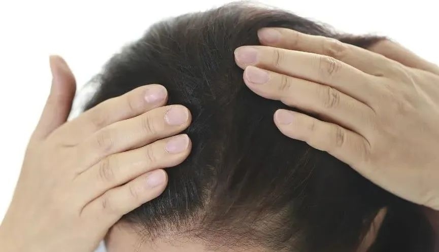 洗完头后，自然风干好，还是吹干好？很多人都做错了
