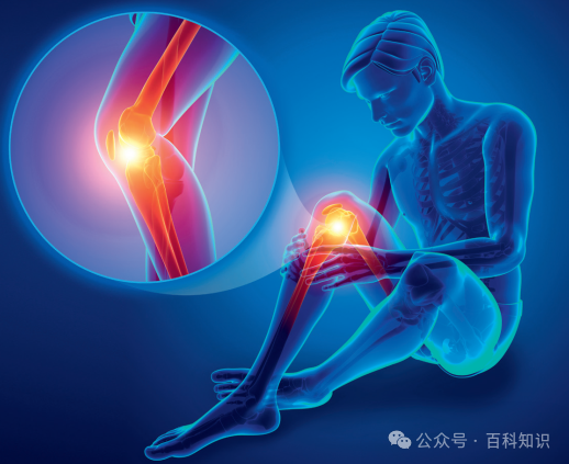 百科知识丨关节&ldquo;咔咔&rdquo;响是因为身体缺钙吗