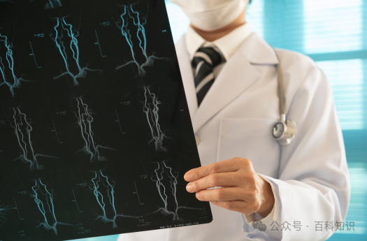 百科知识丨别让误判关上脑卒中的时间窗 （下）