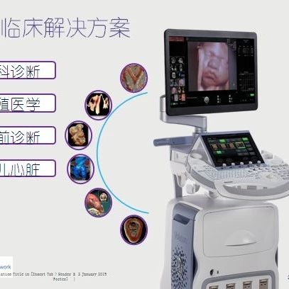 好消息！前郭县医院超声科引进新设备  前郭尔罗斯蒙古族自治县医院  3天前